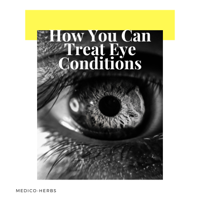 How You Can Treat Eye Conditions - Read This